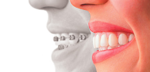 Clinica Dental Duperier en Piedralaves